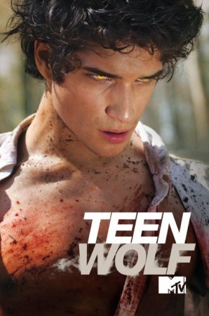 თინეიჯერი მგელი სეზონი 1 / Teen Wolf Season 1 (Tineijeri Mgeli Sezoni 1) ქართულად